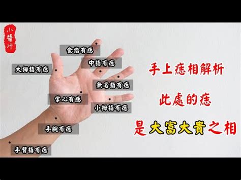 右手肘內側有痣|【手肘內有痣】手肘內有痣是什麼意思？揭開「袖裡藏痣」的驚人。